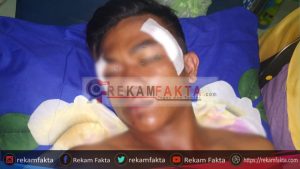 Warga Desa Mootinelo, Diduga Menjadi Korban Penganiayaan
