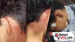 ‎Remaja 15 Tahun Jadi Korban Dugaan Penganiayaan Oknum Polisi Bhabinkamtibmas